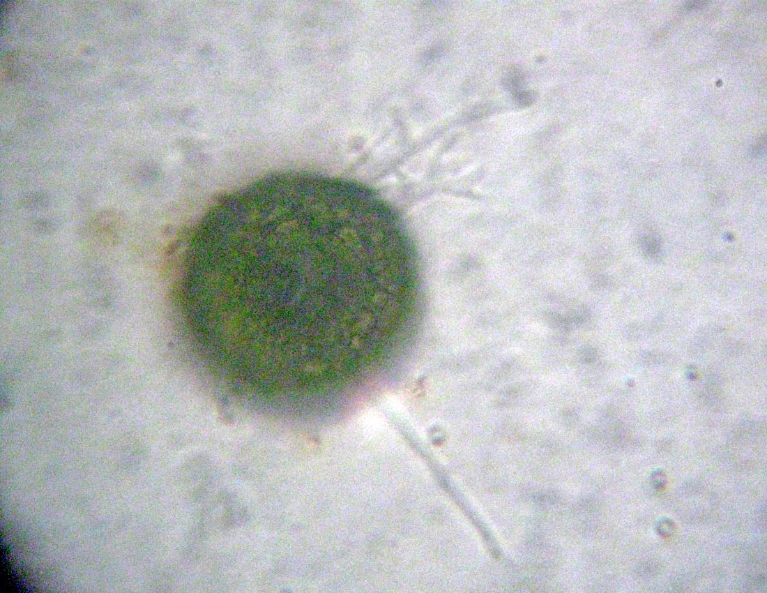 Difflugia verosimilmente gramen